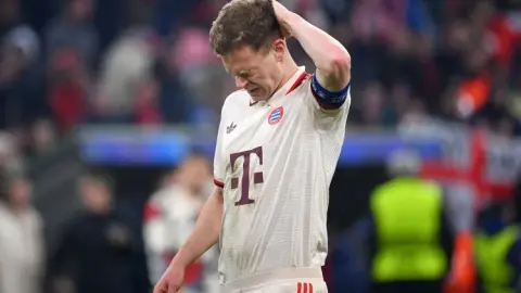 Basler: Bayern nên suy ngẫm về lý do tại sao họ để thủng lưới 5 bàn Kimmich lùi quá sâu để lấy bóng.