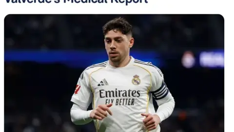 Real Madrid xác nhận Valverde bị chấn thương sọ não, phải nghỉ 10 đến 14 ngày