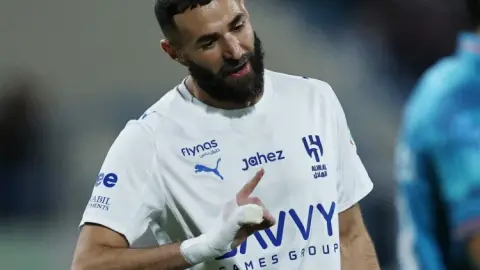 Team News nói về bàn tay quấn băng của cầu thủ: Người ta nói Benzema "mang lửa" có thể mang đến gợi ý tâm lý tốt