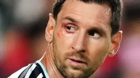 Messi liên tiếp chịu va chạm mạnh nhưng vẫn cùng Argentina vào bán kết World Cup