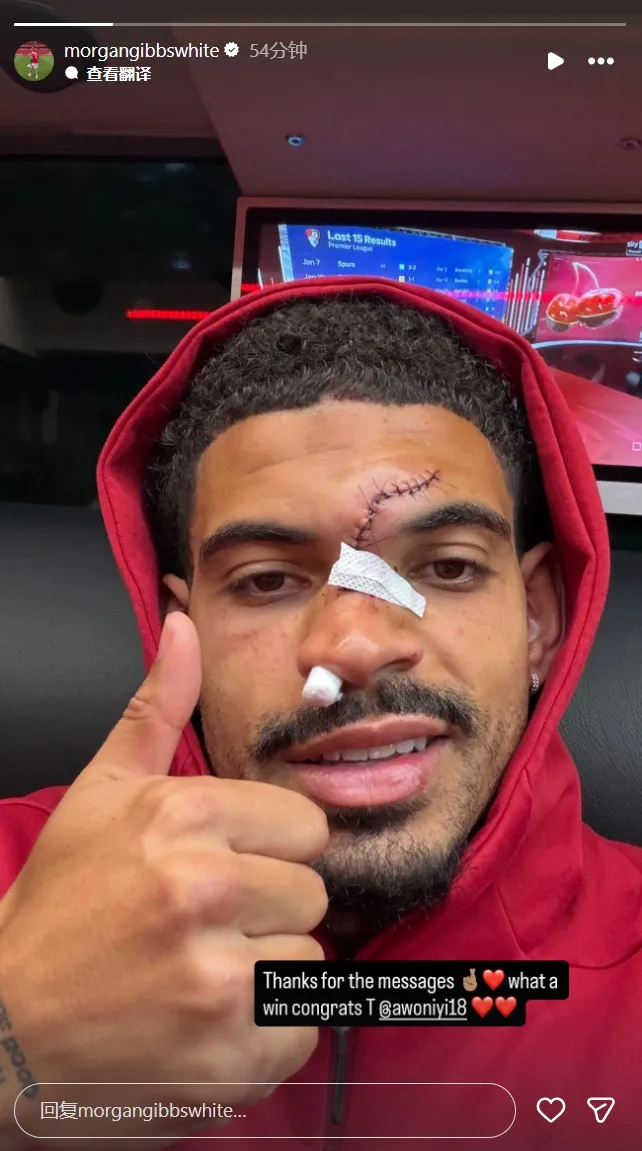 Gibbs-White khâu nhiều mũi ở mặt sau va chạm, vẫn ăn mừng chiến thắng trước Chelsea