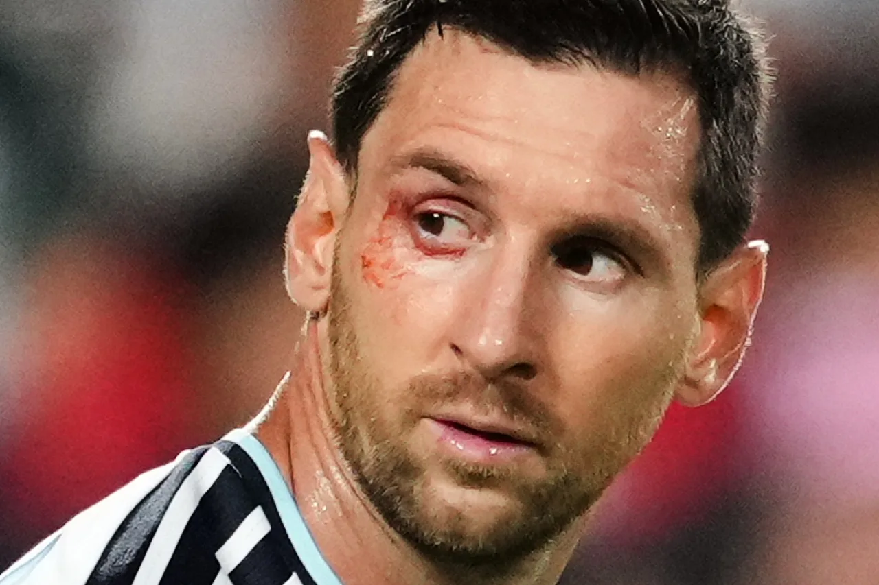 Messi liên tiếp chịu va chạm mạnh nhưng vẫn cùng Argentina vào bán kết World Cup